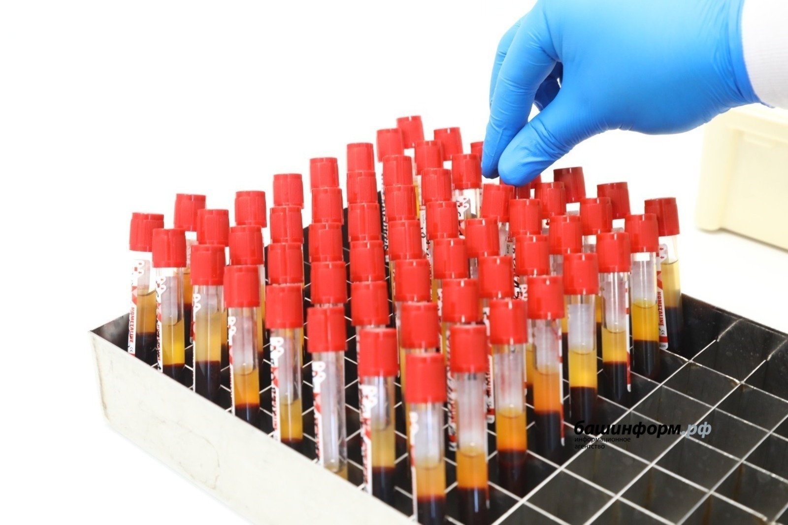 Бөтә донъя СПИДтан вафат булғандарҙы иҫкә алыу көнө